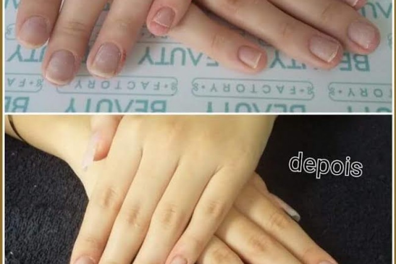 Unhas De Fibra Em Campinas | Roze Capetinga Antes E Depois