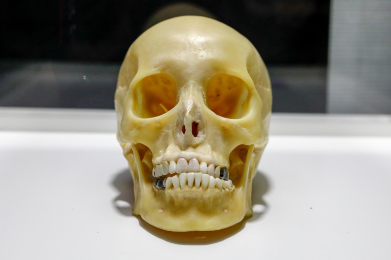 Iguatemi Campinas | Exposição Maravilhas Do Corpo Humano Cranio