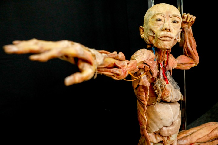 Iguatemi Campinas | Exposição Maravilhas Do Corpo Humano